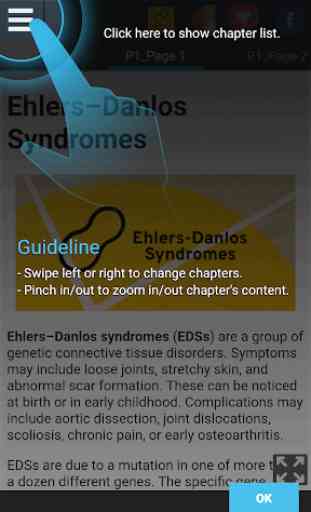 Ehlers–Danlos Syndromes 4