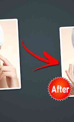 Object Remover -Erase Object -Face Blemish Remover 2