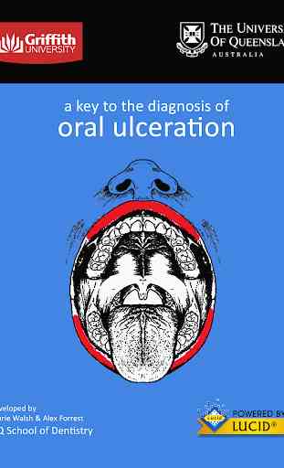 Diagnosis of Oral Ulceration 1