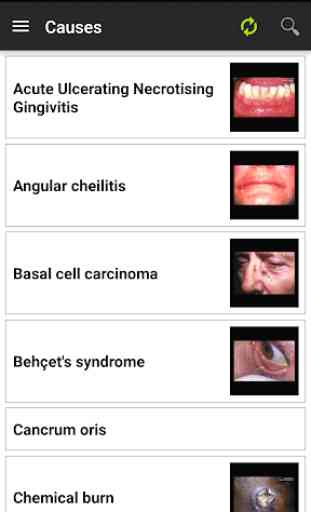 Diagnosis of Oral Ulceration 4
