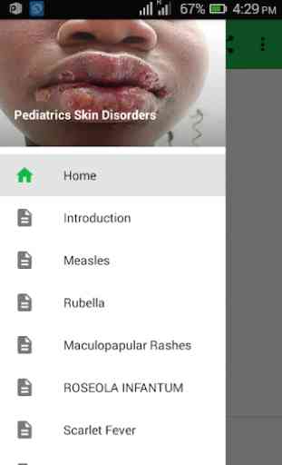 Pediatric Skin Disorders 1
