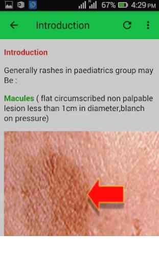 Pediatric Skin Disorders 2