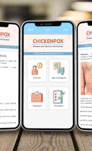 Chickenpox Medical Info 3