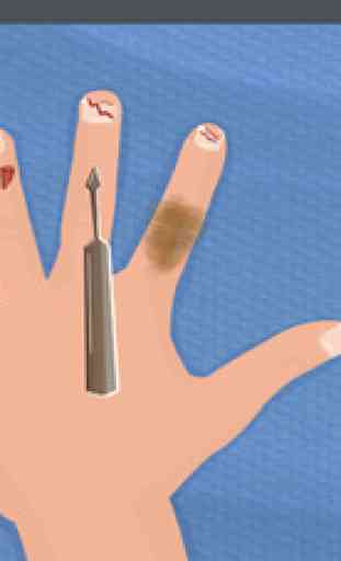 Finger Chirurgie - chirurgien de la main fou et jeu de médecin 3