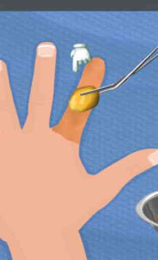 Finger Chirurgie - chirurgien de la main fou et jeu de médecin 4